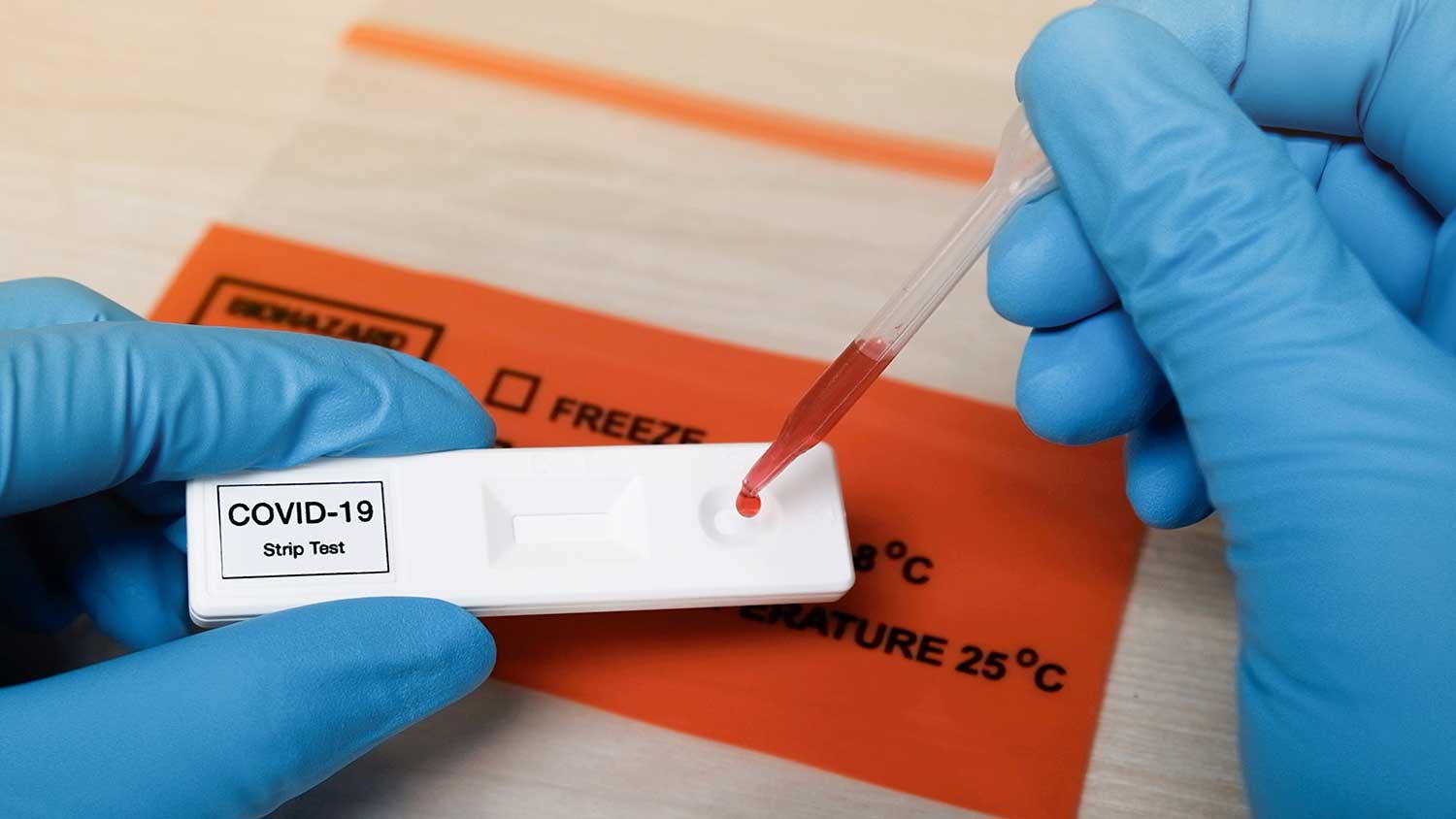 Scientist dropping blood samples onto a test plate labelled COVID-19